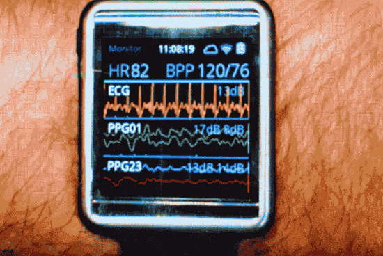 AirPower 消失之后，苹果无线充电技术将会如何发展？